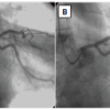 Figure 38